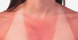 Olio di coronopo del mare contro eczema